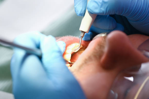 Best Emergency Treatment for Oral Infections in Defuniak Springs, FL