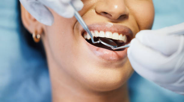 Best Knocked-Out Tooth (Avulsed Tooth) Treatment in Defuniak Springs, FL
